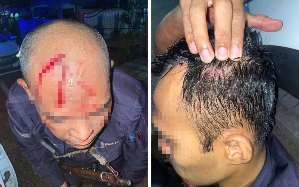 இரு போலீஸ்காரர்கள் வெட்டுக்காயங்களுக்கு ஆளாகினர்