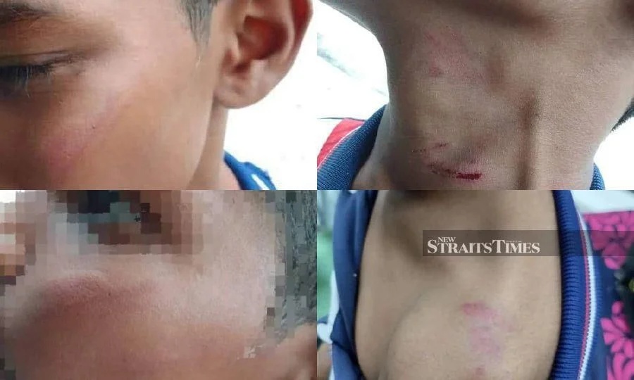 மாணவனுக்கு கடும் காயம் விளைவித்ததாக தலைமையாசிரியருக்கு எதிராக புகார்