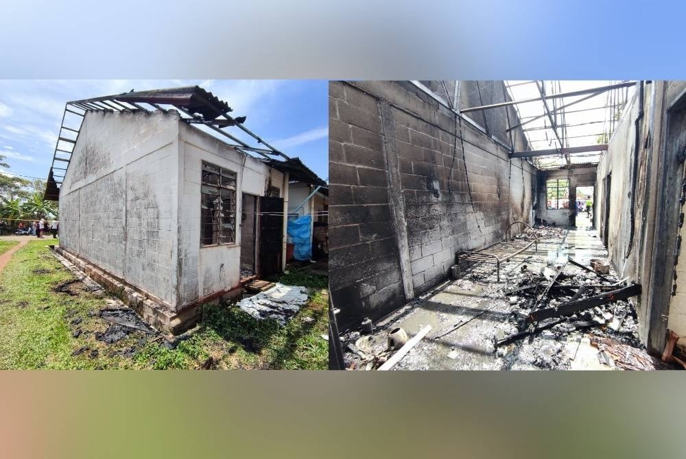 இரண்டு உடன்பிறப்புகள் ​தீக்காயங்களுடன் உயிர் தப்பினர்