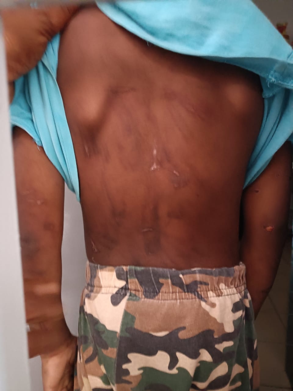 பூட்டப்பட்ட வீட்டில்  உடலில் கடும் காயங்களுடன் 4 வயது இந்தியச் சிறுவன் மீட்கப்பட்டான்