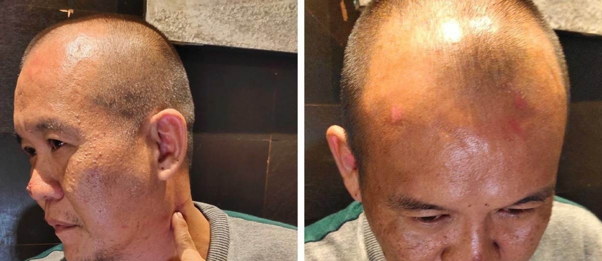 தாக்கப்பட்டது மட்டுமின்றி துப்பாக்கி மிரட்டலுக்கு ஆளாகிய ஆடவர்