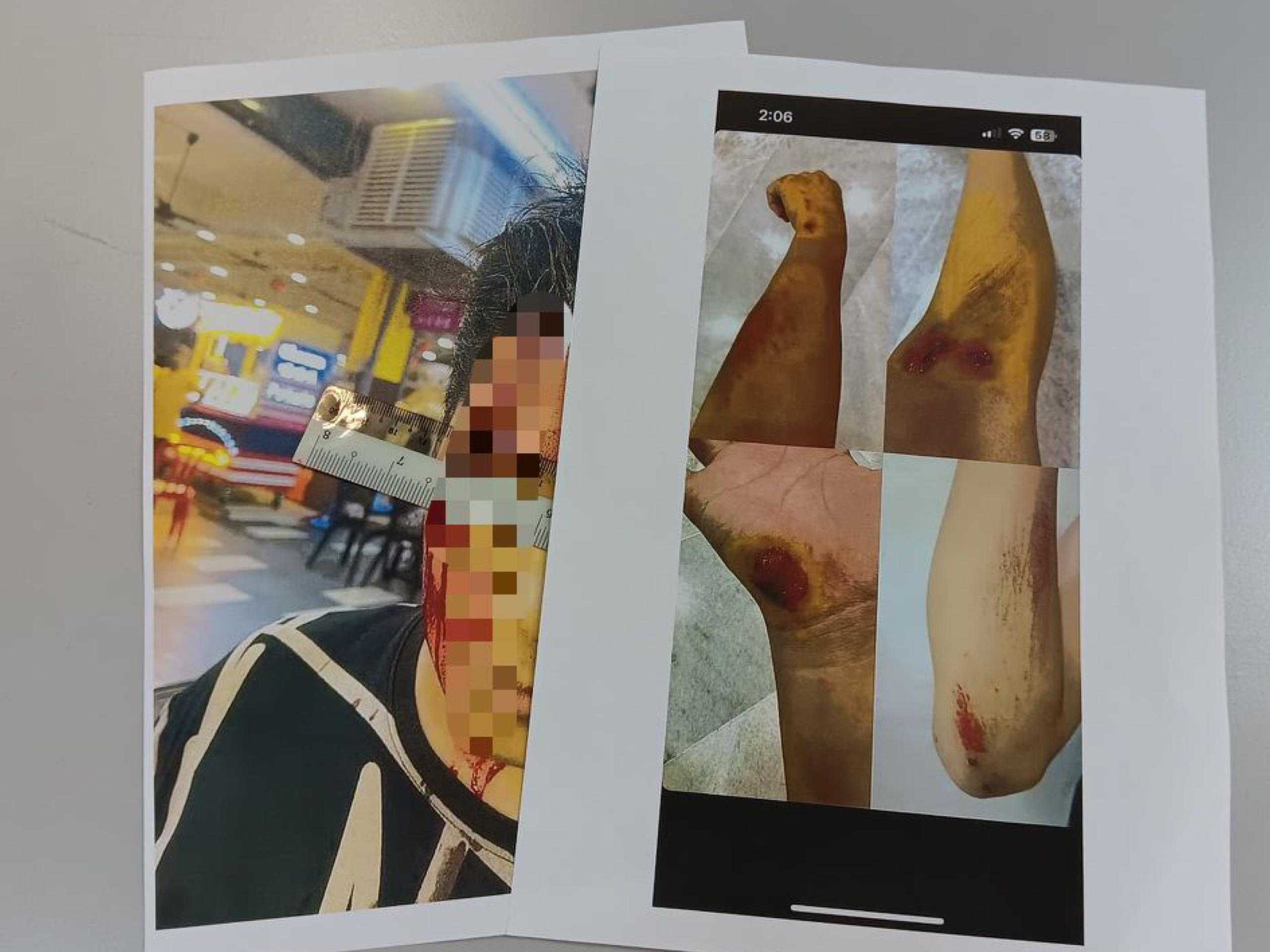 7 இடைநிலைப்பள்ளி மாணவர்கள் கைது