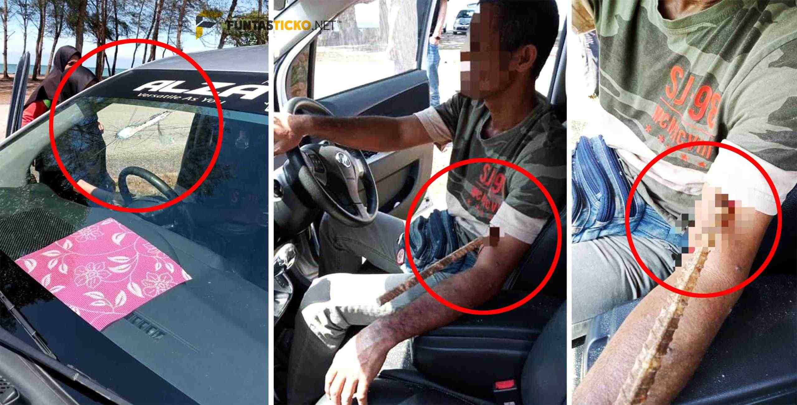 லோரியிலிருந்து விழுந்த இரும்பு கம்பி, வாகனமோட்டியின் விலா எலும்பை பதம் பார்த்தது