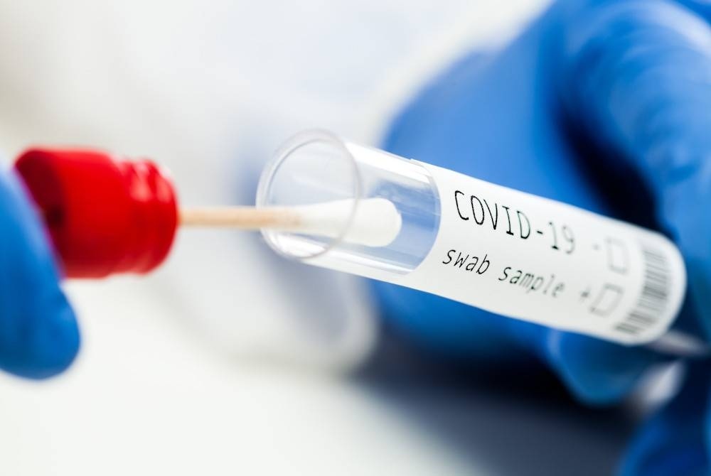 கோவிட் 19 நோய்தொற்று 14.8 விழுக்காடு அதிகரிப்பு