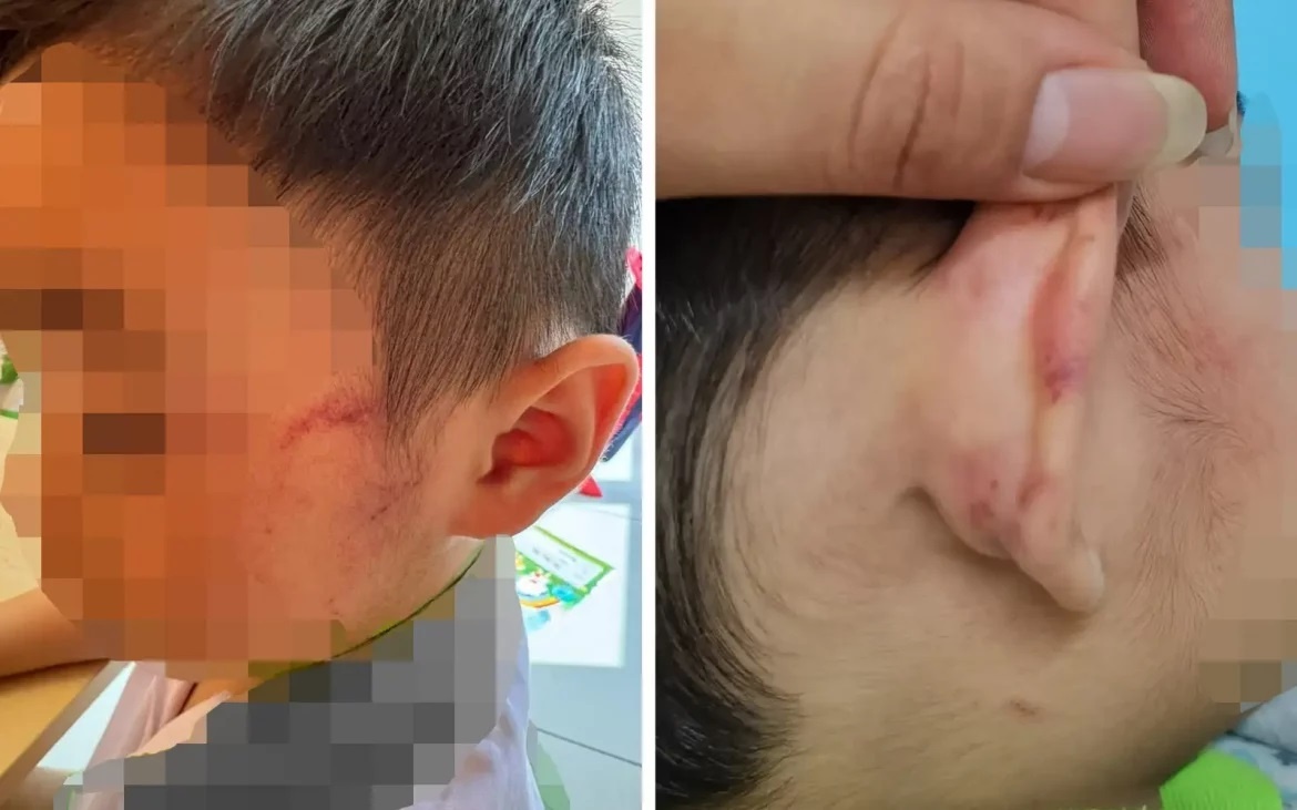 மகனை துன்புறுத்திய ஆசிரியர் மீது நடவடிக்கை எடுக்க தந்தை கோரிக்கை