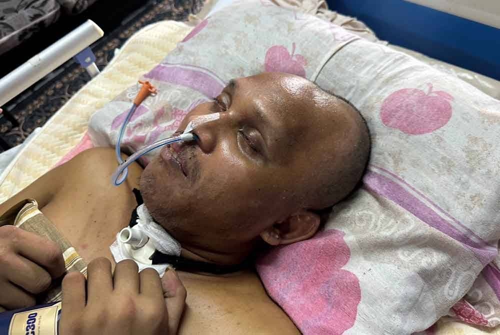 தலையில் தேங்காய் விழுந்ததால் கோமாவில் இருந்த ஆடவர் சுயநினைவு திரும்பினார்