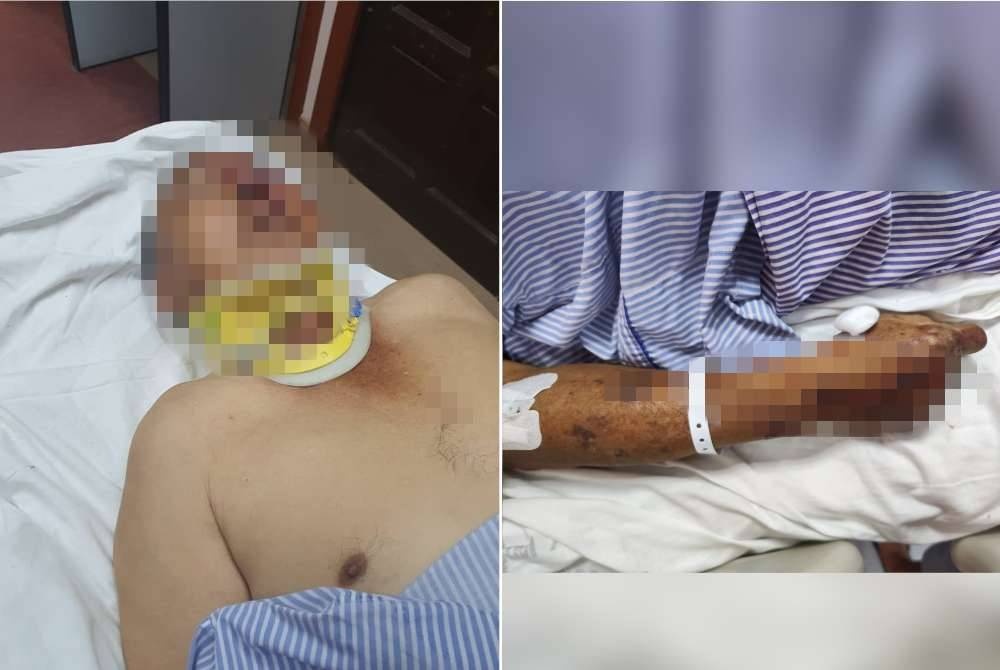 முதியவர் கடுமையாக தாக்கப்பட்டார்