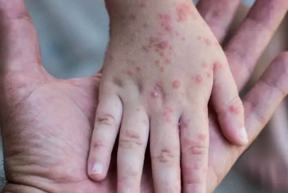 நாட்டின் நுழைவுப் பகுதிகளில் கண்காணிப்பு வலுப்படுத்தப்படும்