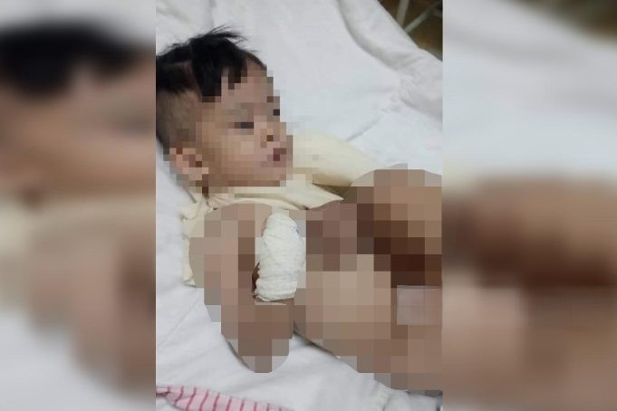 குழந்தை சித்ரவரை, கணவன், மனைவி கைது