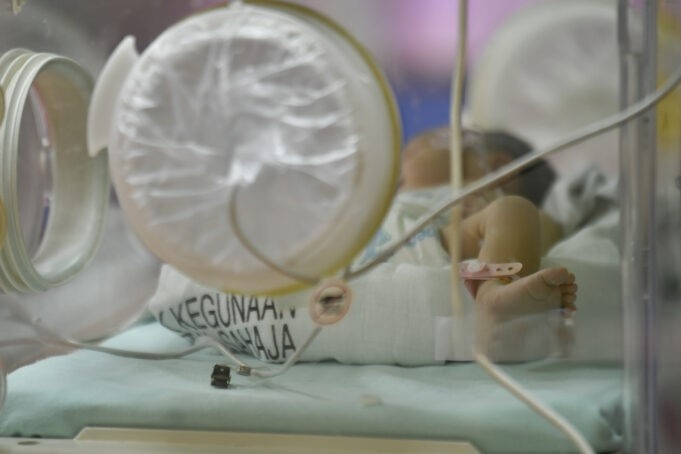 தொப்புள் கொடி அவிழ்க்கப்படாத நிலையில் சிசு