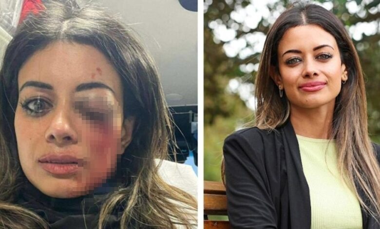 ஹான்னா தோமஸ் கண் பார்வையை இழக்க நேரிடலாம்