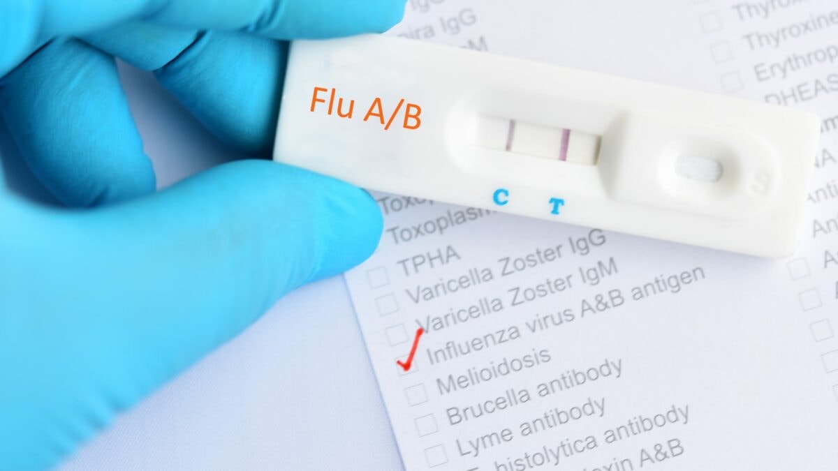 இன்ஃபுளுவென்ஸா சம்பவங்கள் குறைந்துள்ளன