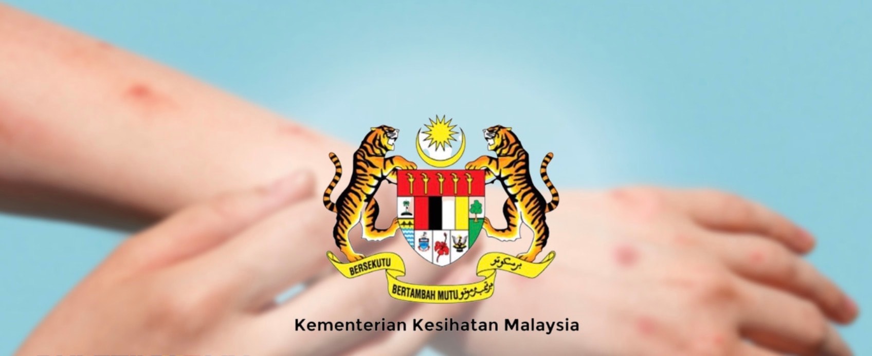 குரங்கம்மை நோய்த் தொற்று உறுதி! குடும்பத்துடன் 4 பேருக்குத் தொற்று! மேற்கு ஆப்பிரிக்கா தொடர்பால் சுகாதார அமைச்சு அதிர்ச்சி!