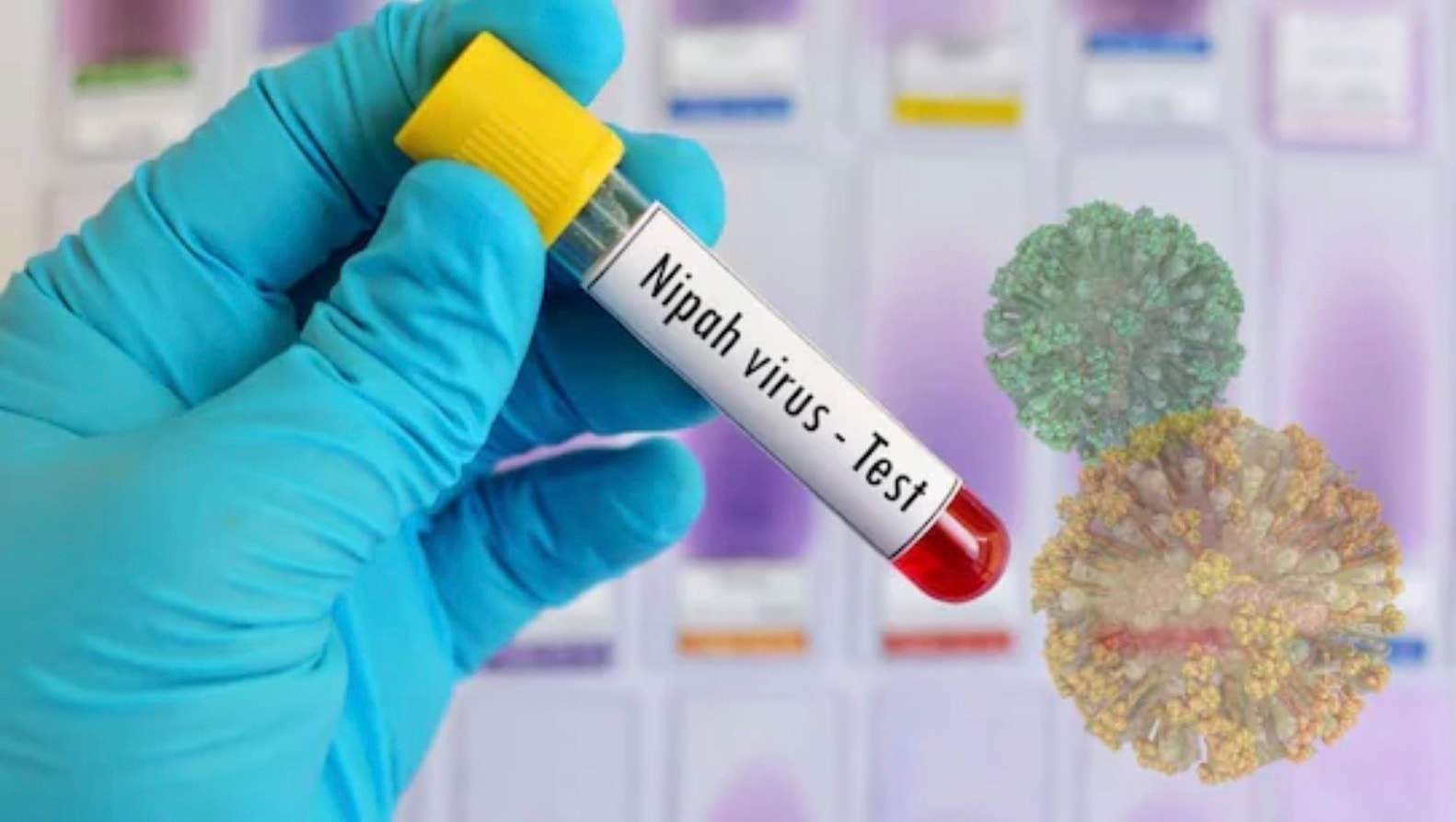 மலேசியாவில் நிப்பா வைரஸ் அச்சுறுத்தல் இல்லை: சுகாதார அமைச்சு