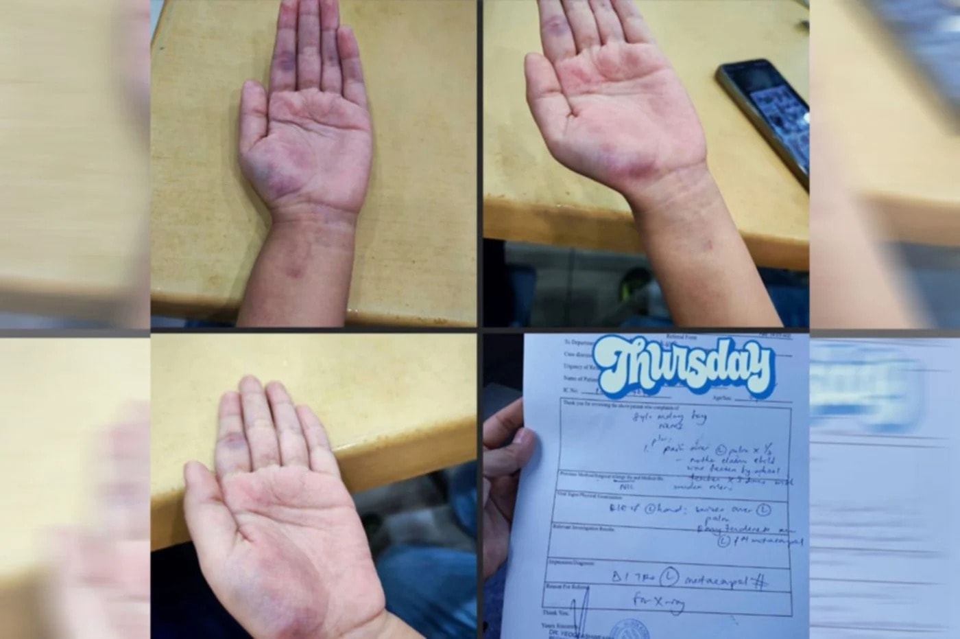 பினாங்கில் பிரம்படியால் இரண்டாம் ஆண்டு மாணவருக்குக் காயம் - மாநில கல்வித்துறை விசாரணை